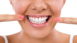 Cara Memutihkan Gigi menggunakan Bahan Alami