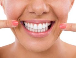 Cara Memutihkan Gigi menggunakan Bahan Alami