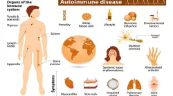 Mengenal Lebih Dekat Penyakit Autoimun: Penyebab, Gejala, dan Pengobatannya