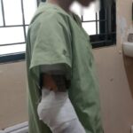 Bocah Perempuan di Semarang Diduga Dibakar Paman, Awalnya gara-gara Tak Mau Mandi